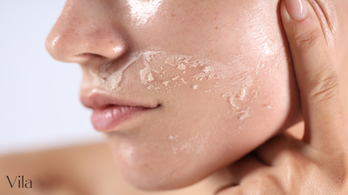 Suva koža u menopauzi: uzroci, simptomi i pravilna nega